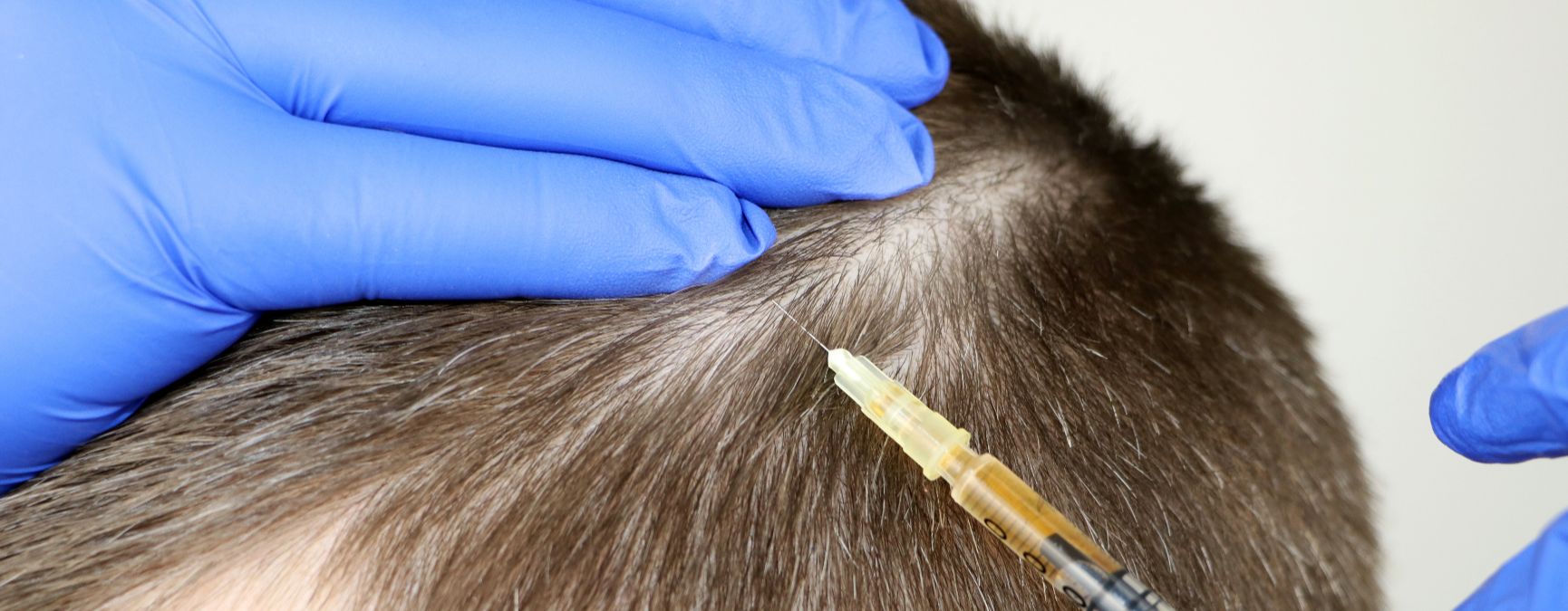 Occipital nerve block injection procedure