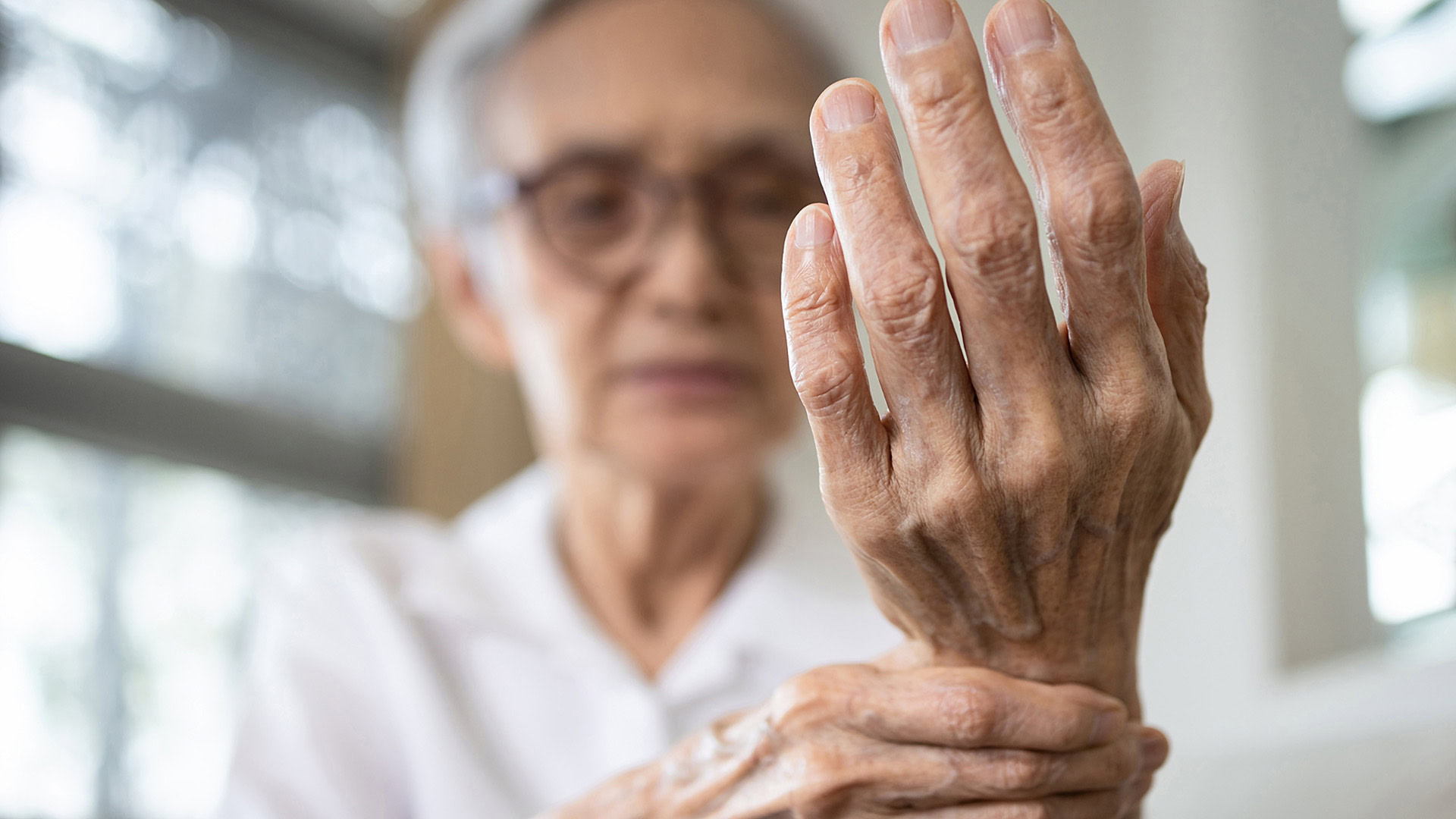 Elderly female patient suffer from numbing pain in hand